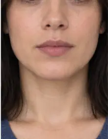 Refused example: top of the head cut off by the edge